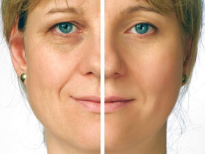 Anti-Aging Treatments – Youthful Skin, Naturally