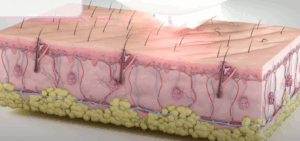 Laser Hair Reduction – Smooth, Lasting Results