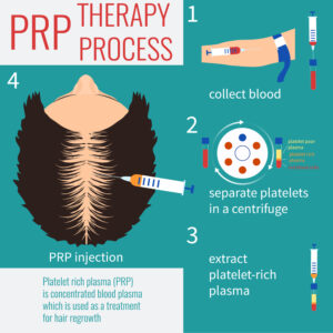 The PRP Process – Step by Step